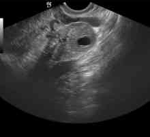 Жълтото тяло в яйчника по време на бременност