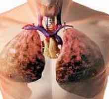 Течност в белите дробове причини, симптоми, лечение