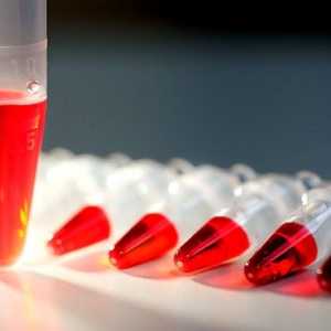 Кръвни тестове за тироидни хормони
