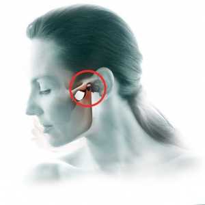 Артрит лицево-челюстни общи симптоми и лечението