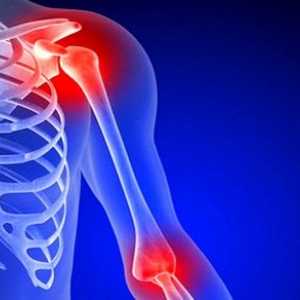Остеоартритът на раменната става: симптоми и лечение