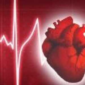 Какво е нарушен сърдечен ритъм?