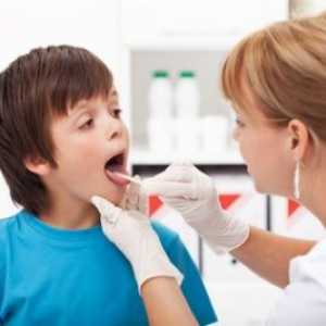 Фарингит при деца - симптоми и лечение на фарингит на детето