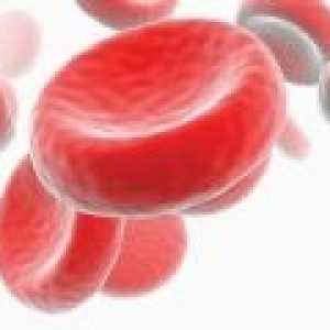 Хипохромна анемия: Видове и лечение