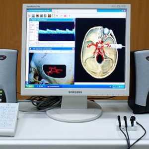 Използване на плавателни съдове триплекс сканиране врата и мозъка