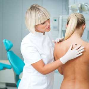 Как да разпознаем и лечение на меланом гръбнака