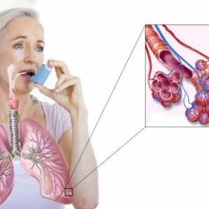 Как да се лекува астма