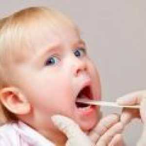 Кашлица при дете на 3 години - причини, видове, лечение.