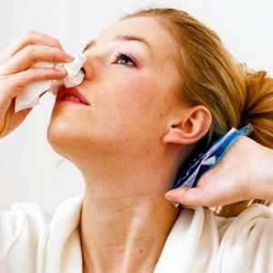 Кръвотечение от носа: причини