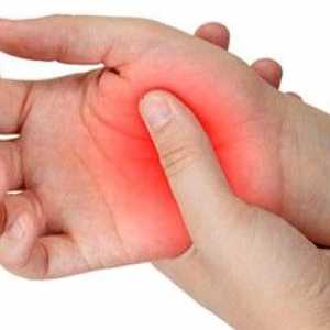 Лечение на артрит в дома лекарствата от народната медицина