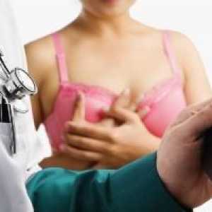 Мастектомия - операция за отстраняване на гърдата