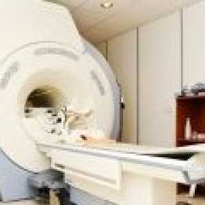 MRI на мозъка