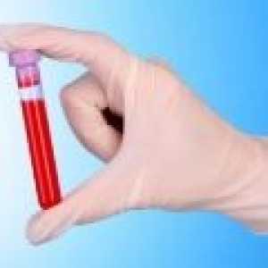 Нов кръвен тест при деца със сътресение