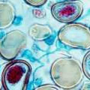 Перфузия - метод на доставка биологична тъкан