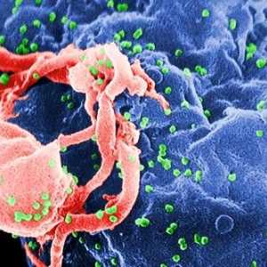 Първите симптоми на ХИВ