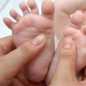 Плоски крака при децата, причини, лечение