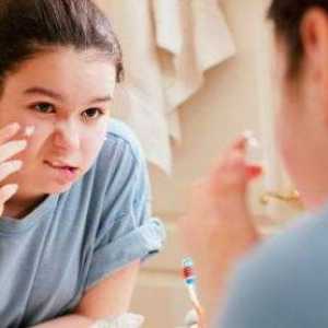 Teenage акне: ефективно и ефикасно лечение