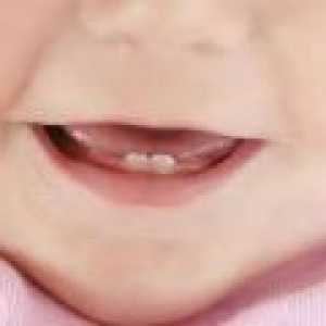 Диария по време на никнене на млечни зъби бебета