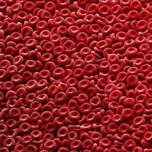 Повишени червените кръвни клетки в кръвта