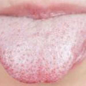 Причини за сухота в устата и езика покритие