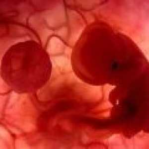 Причините за спонтанен аборт в ранна бременност