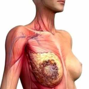 Признаци на рак при жените гръдната кост
