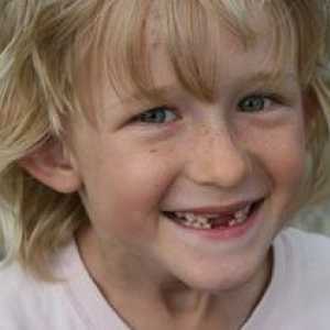 Замяна на зъби при деца