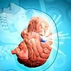 Субдурален хематом на мозъка: причините, симптоми, лечение