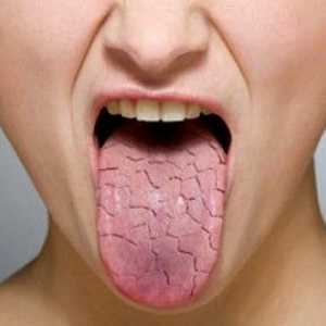 Сухотата в устата - причинява заболяване,