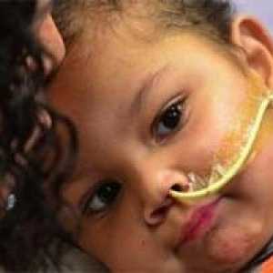 Тригодишен момче трансплантирани в същото време на петте органи донори