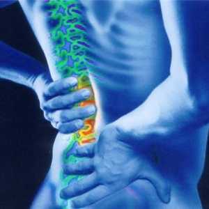 Притискане на нервите в гръбначния стълб: Лечение