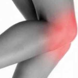 Травма на коляното