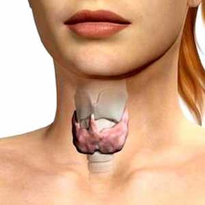 Нодуларна гуша на щитовидната жлеза