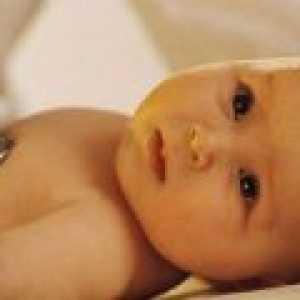 Пневмония при деца: симптоми, лечение