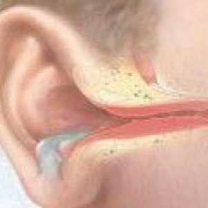 Възпаление на средното ухо: Предизвиква, Лечение