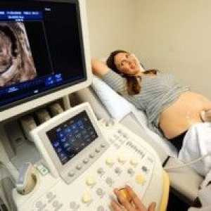 Вреден при ултразвук по време на бременност? Колко пъти можете да направите?